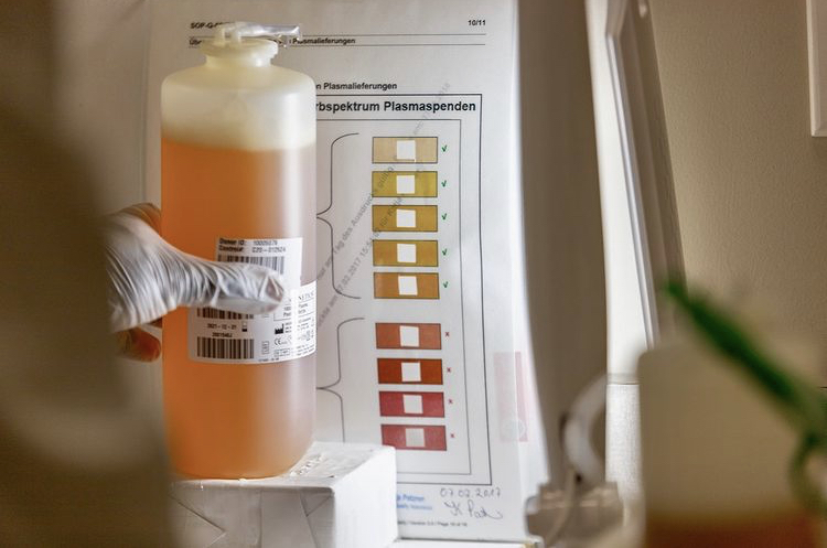 Why Blood Plasma Isn T Always Yellow Canadian Plasma Resources